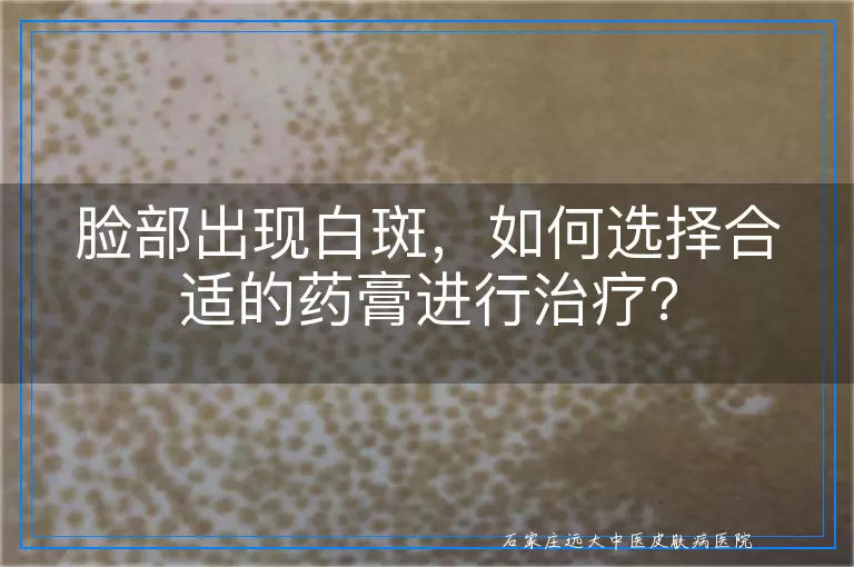 脸部出现白斑，如何选择合适的药膏进行治疗？