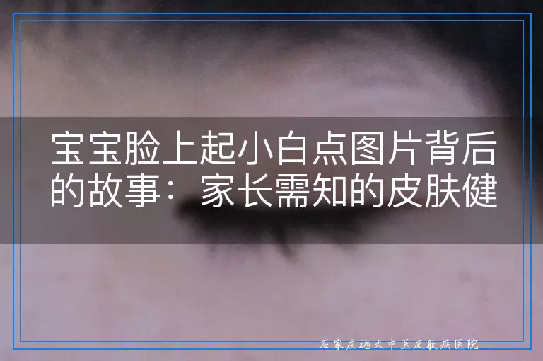 宝宝脸上起小白点图片背后的故事：家长需知的皮肤健康小信号与白癜风初步识别