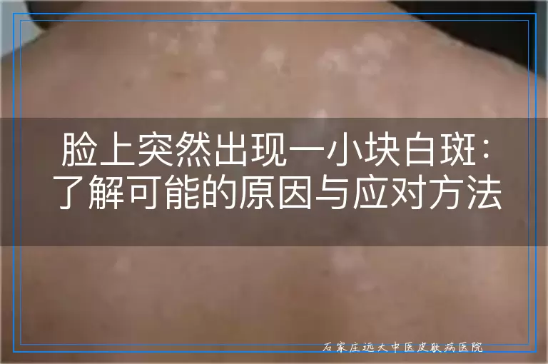 脸上突然出现一小块白斑：了解可能的原因与应对方法