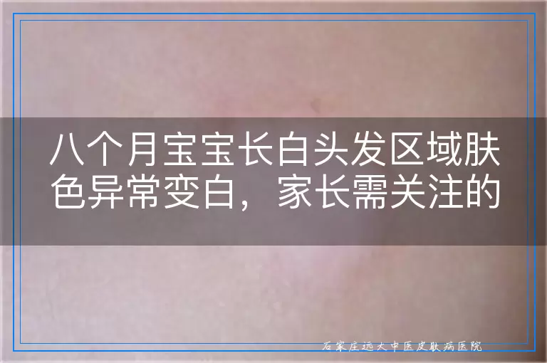八个月宝宝长白头发区域肤色异常变白，家长需关注的可能原因与应对建议