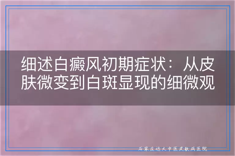 细述白癜风初期症状：从皮肤微变到白斑显现的细微观察指南，附带百度图片参考