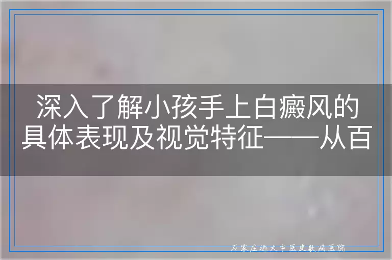 深入了解小孩手上白癜风的具体表现及视觉特征——从百度图片说起