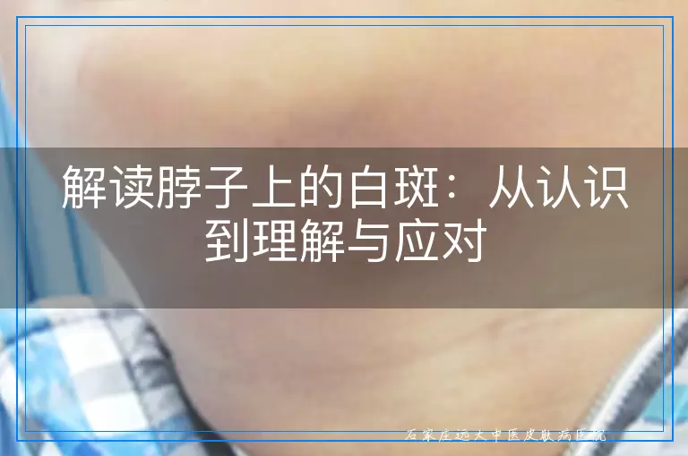 解读脖子上的白斑：从认识到理解与应对