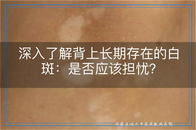深入了解背上长期存在的白斑：是否应该担忧？