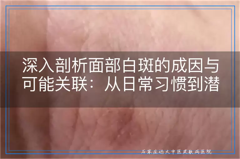 深入剖析面部白斑的成因与可能关联：从日常习惯到潜在病理