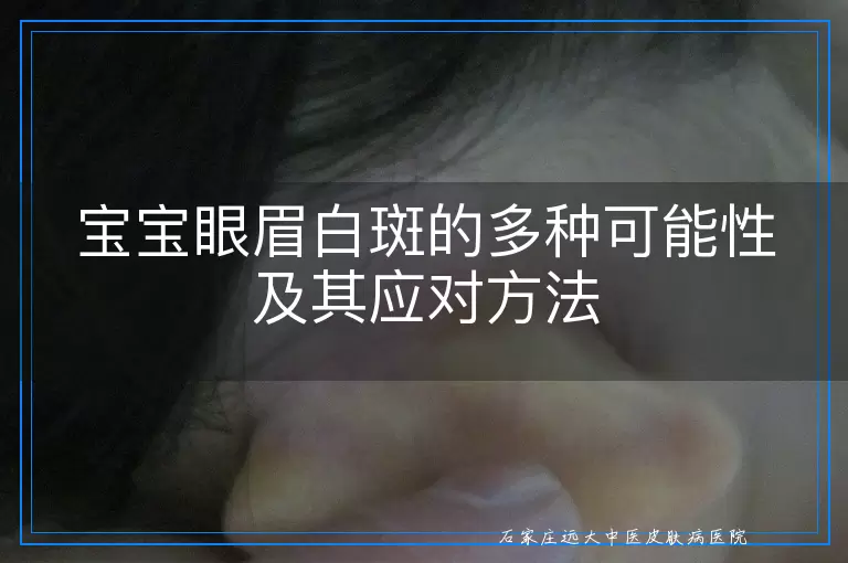 宝宝眼眉白斑的多种可能性及其应对方法