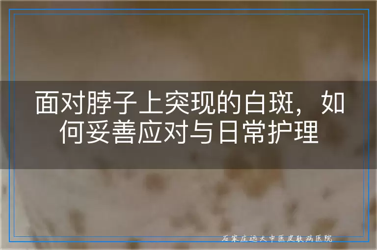 面对脖子上突现的白斑，如何妥善应对与日常护理