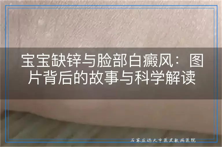 宝宝缺锌与脸部白癜风：图片背后的故事与科学解读
