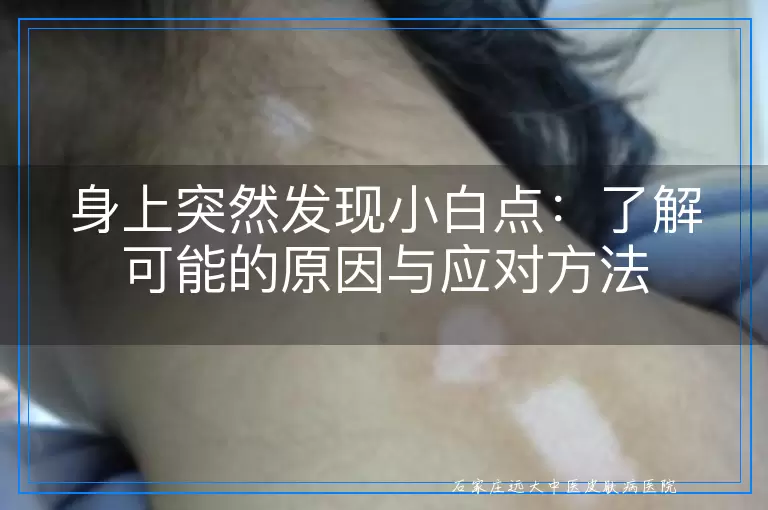 身上突然发现小白点：了解可能的原因与应对方法