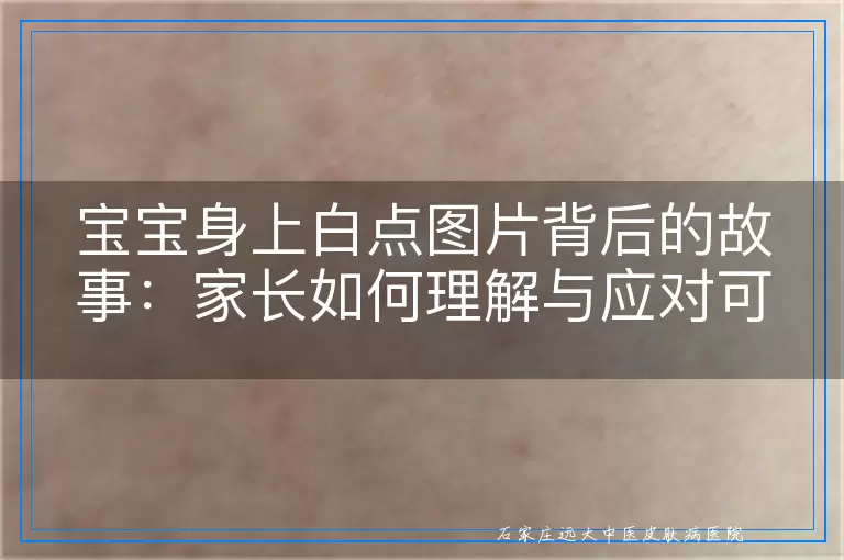 宝宝身上白点图片背后的故事：家长如何理解与应对可能的白癜风迹象