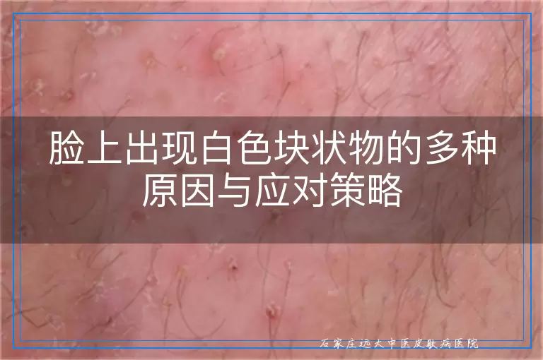 脸上出现白色块状物的多种原因与应对策略