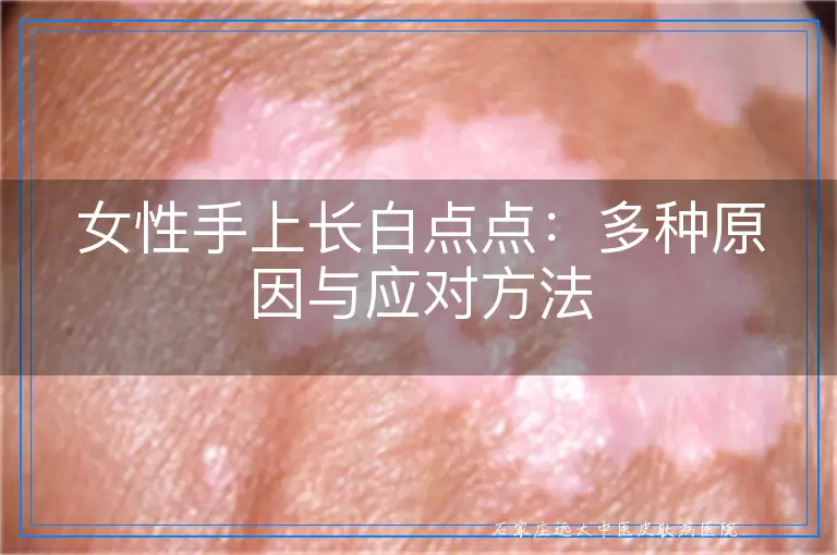 女性手上长白点点：多种原因与应对方法
