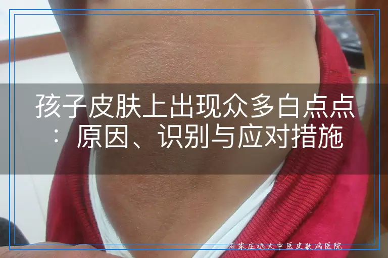 孩子皮肤上出现众多白点点：原因、识别与应对措施