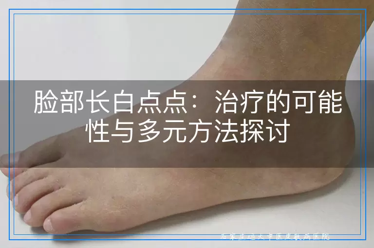 脸部长白点点：治疗的可能性与多元方法探讨