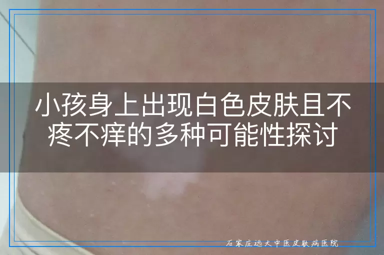 小孩身上出现白色皮肤且不疼不痒的多种可能性探讨