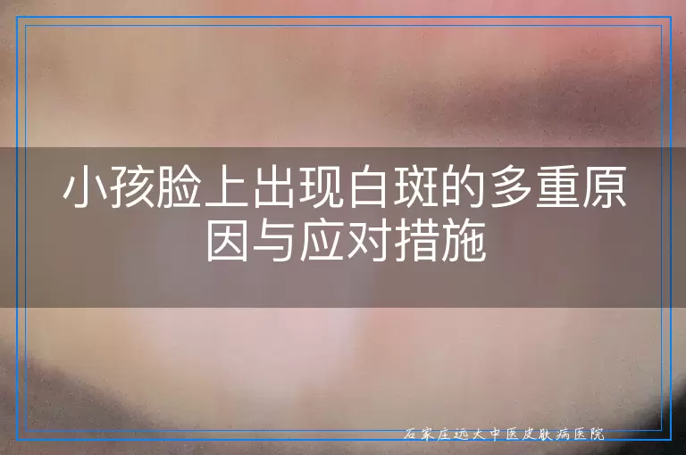 小孩脸上出现白斑的多重原因与应对措施