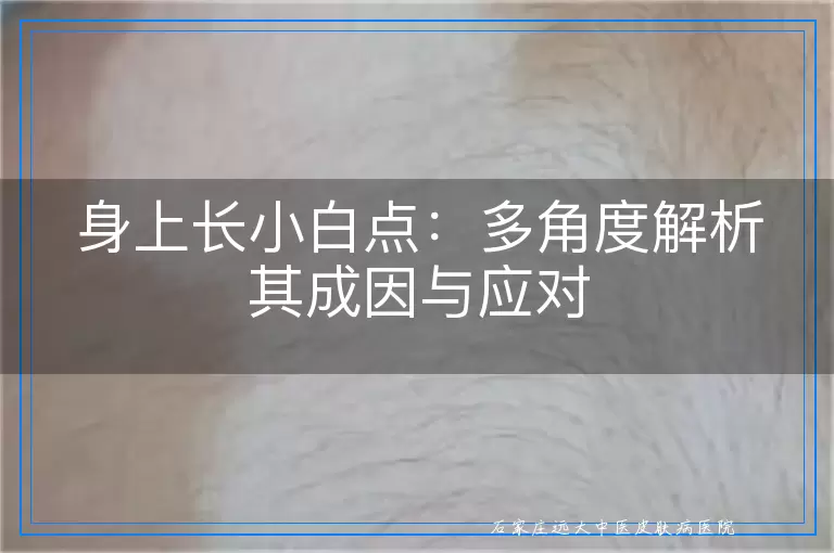 身上长小白点：多角度解析其成因与应对