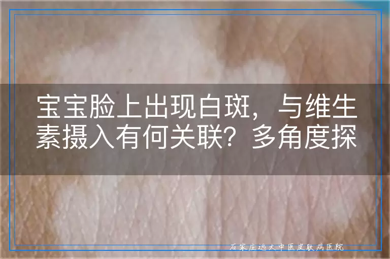 宝宝脸上出现白斑，与维生素摄入有何关联？多角度探讨
