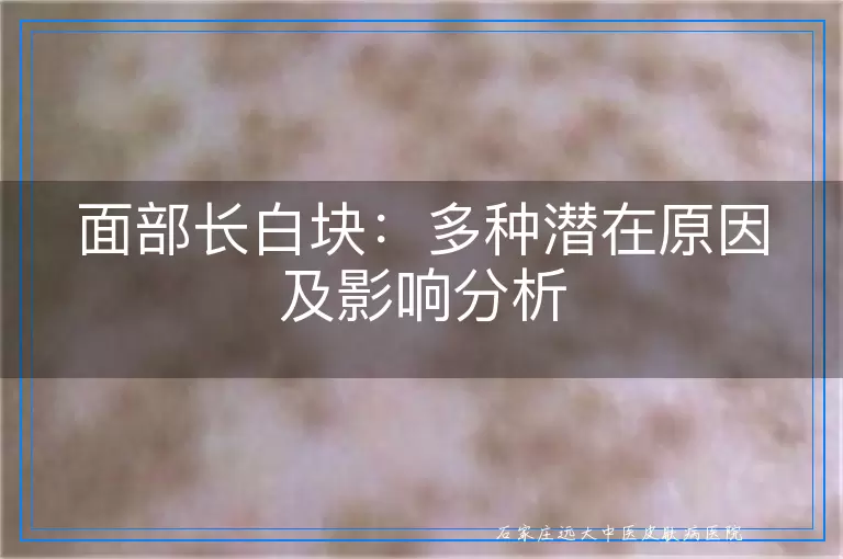 面部长白块：多种潜在原因及影响分析