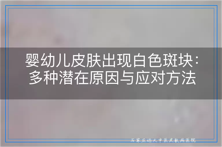 婴幼儿皮肤出现白色斑块：多种潜在原因与应对方法
