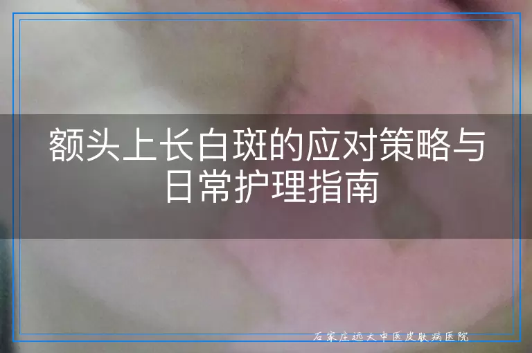 额头上长白斑的应对策略与日常护理指南