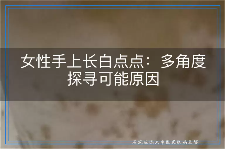 女性手上长白点点：多角度探寻可能原因