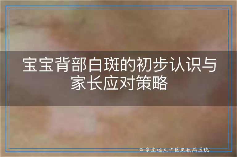 宝宝背部白斑的初步认识与家长应对策略