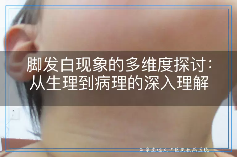 脚发白现象的多维度探讨：从生理到病理的深入理解