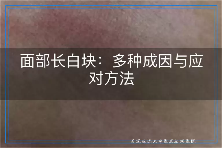 面部长白块：多种成因与应对方法