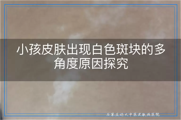 小孩皮肤出现白色斑块的多角度原因探究