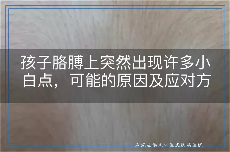 孩子胳膊上突然出现许多小白点，可能的原因及应对方法