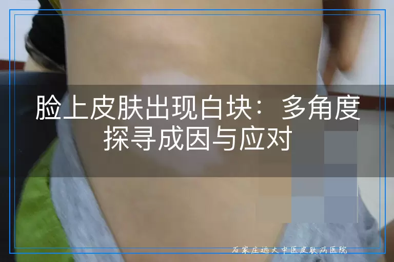 脸上皮肤出现白块：多角度探寻成因与应对