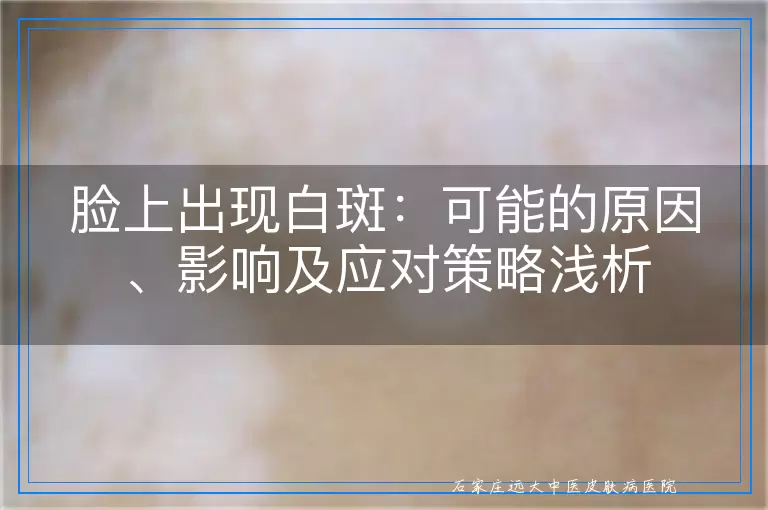 脸上出现白斑：可能的原因、影响及应对策略浅析