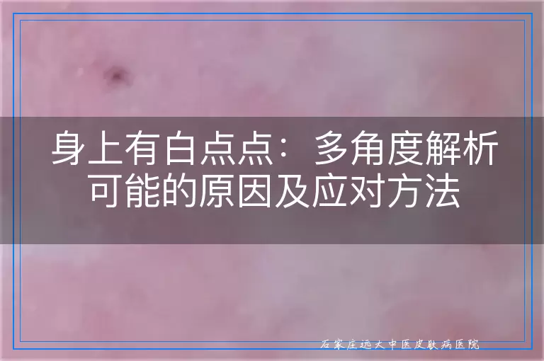 身上有白点点：多角度解析可能的原因及应对方法