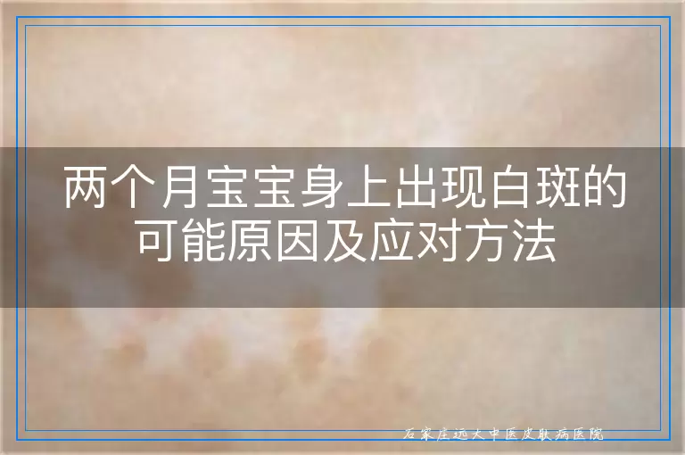 两个月宝宝身上出现白斑的可能原因及应对方法