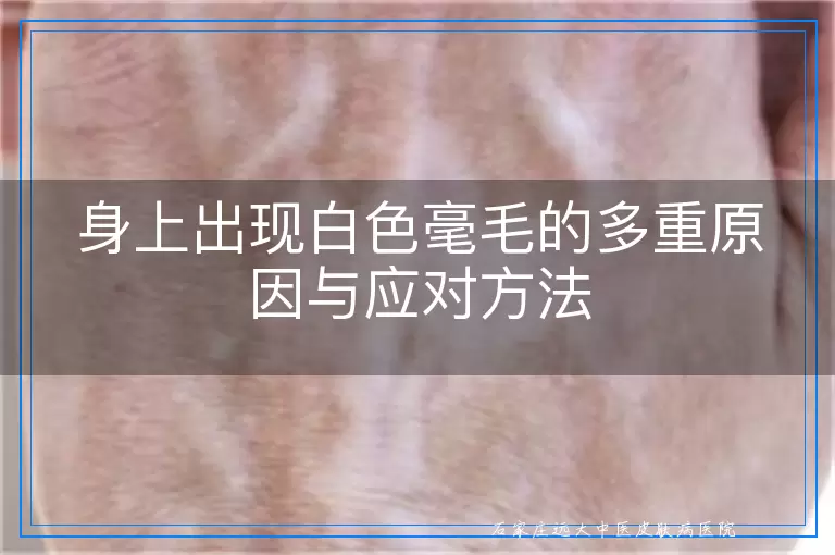 身上出现白色毫毛的多重原因与应对方法