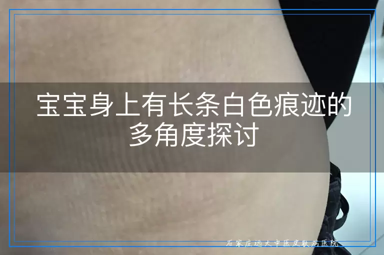 宝宝身上有长条白色痕迹的多角度探讨