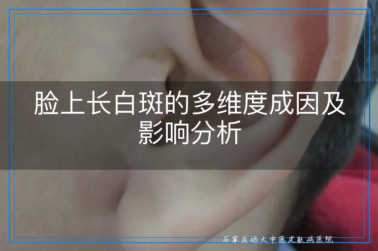脸上长白斑的多维度成因及影响分析