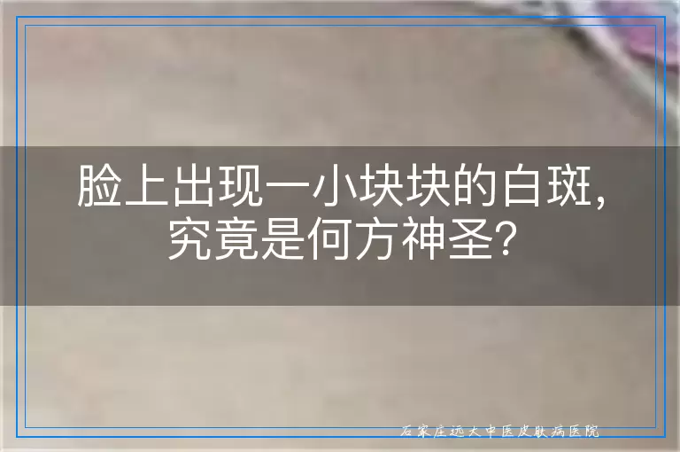 脸上出现一小块块的白斑，究竟是何方神圣？