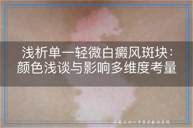浅析单一轻微白癜风斑块：颜色浅谈与影响多维度考量