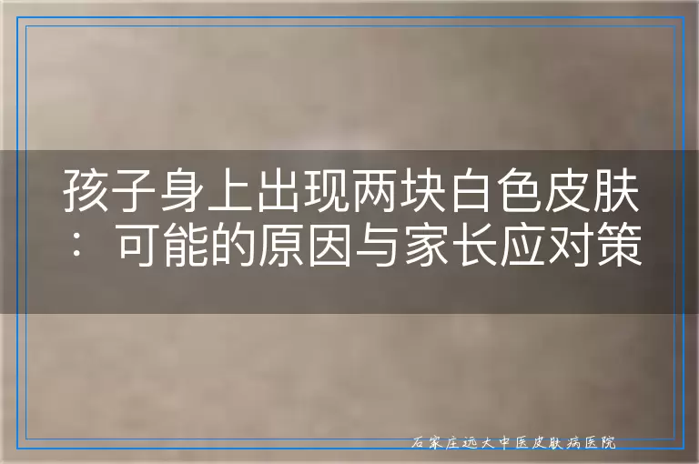 孩子身上出现两块白色皮肤：可能的原因与家长应对策略
