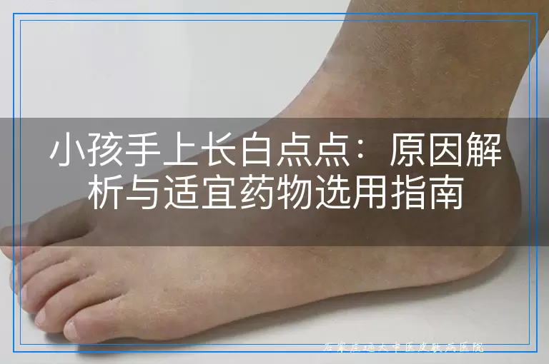 小孩手上长白点点：原因解析与适宜药物选用指南