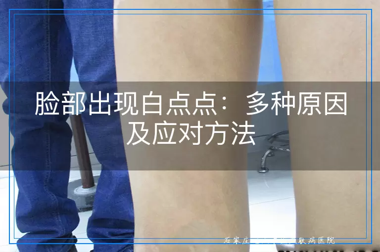 脸部出现白点点：多种原因及应对方法