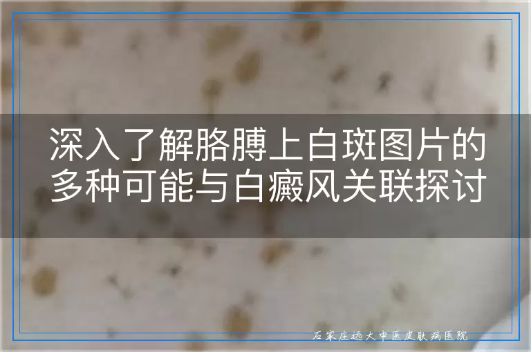 深入了解胳膊上白斑图片的多种可能与白癜风关联探讨
