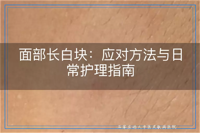 面部长白块：应对方法与日常护理指南