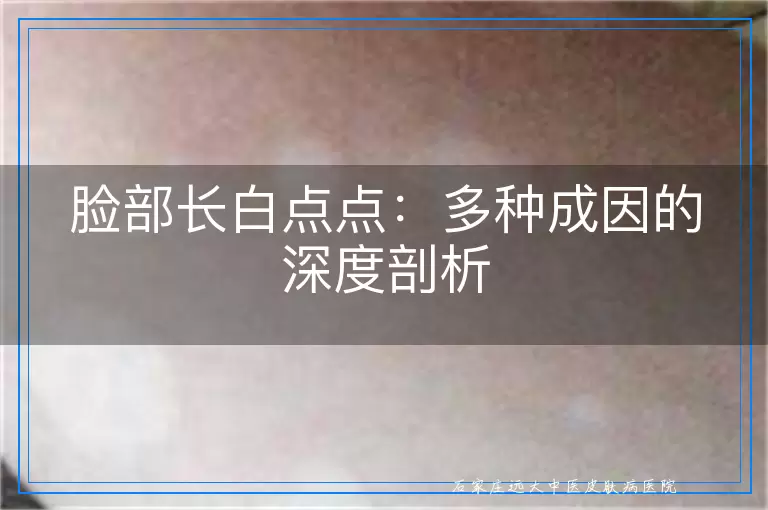 脸部长白点点：多种成因的深度剖析