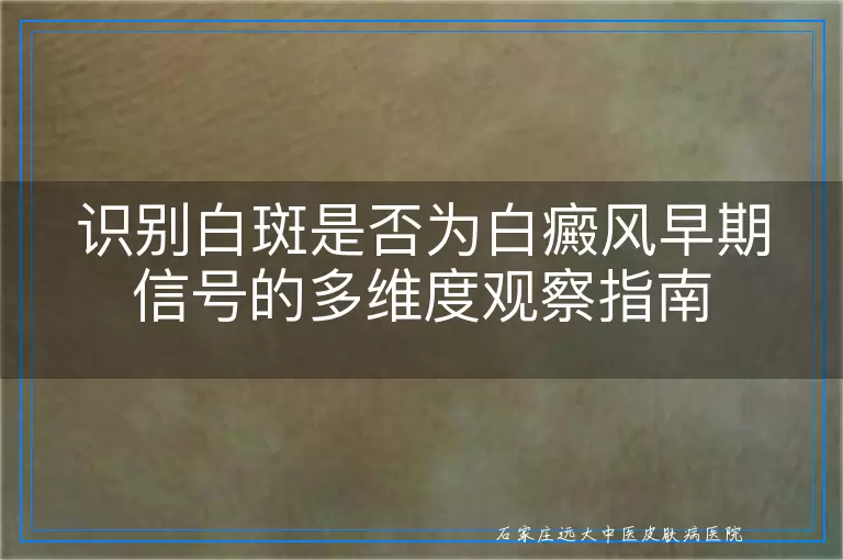 识别白斑是否为白癜风早期信号的多维度观察指南