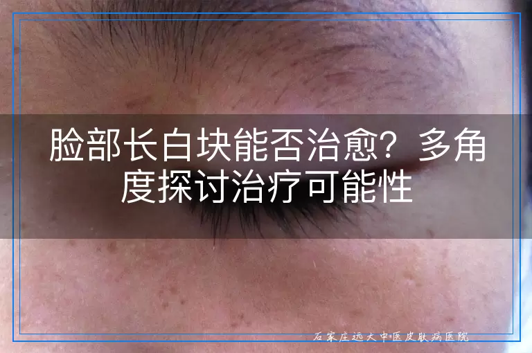 脸部长白块能否治愈？多角度探讨治疗可能性