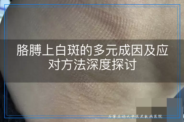 胳膊上白斑的多元成因及应对方法深度探讨