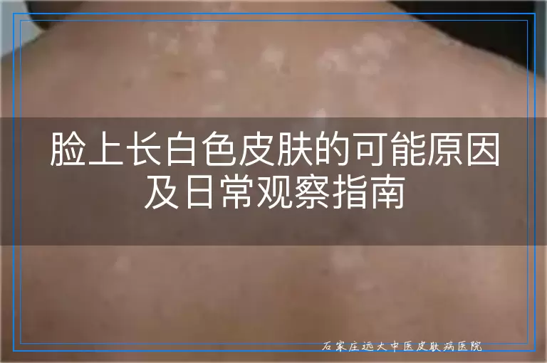 脸上长白色皮肤的可能原因及日常观察指南